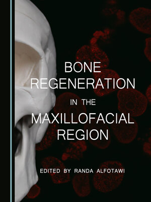 cover image of Bone Regeneration in the Maxillofacial Region